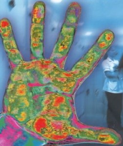 Germs on the hand